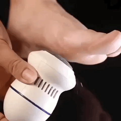 Removedor Eléctrico de Callos